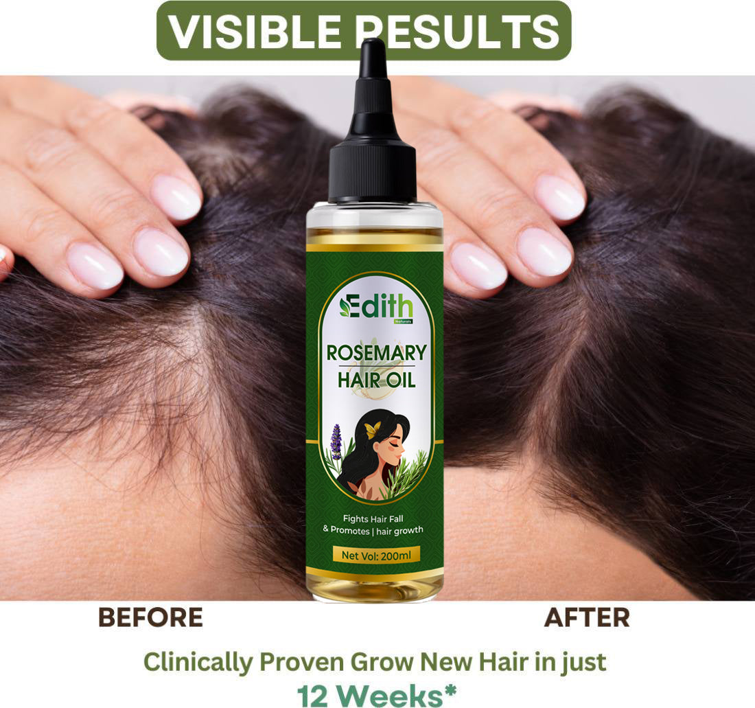 Edith Naturals Rosemary Hair Oil for Hair Growth and Hair Fall Control, Hair Strengthening-200 ml