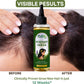 Edith Naturals Rosemary Hair Oil for Hair Growth and Hair Fall Control, Hair Strengthening-200 ml