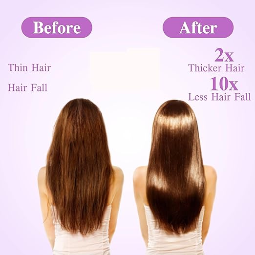 Edith Naturals Rosemary Hair Oil for Hair Growth and Hair Fall Control, Hair Strengthening-200 ml