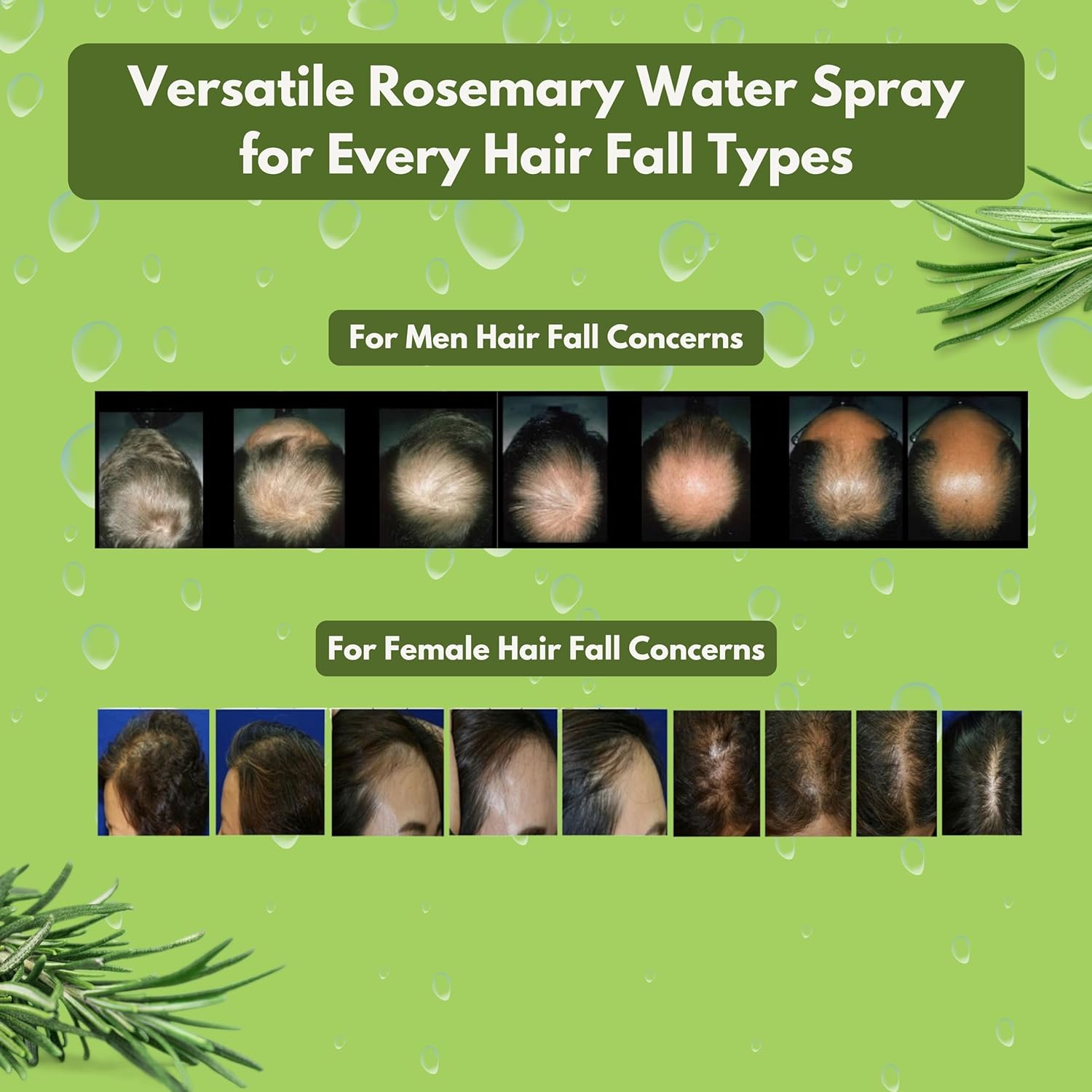 "Edith Naturals Rosemary Revival Spray | Hair Growth & Scalp Nourishment | Nature's Care in a Bottle" Pack of 2