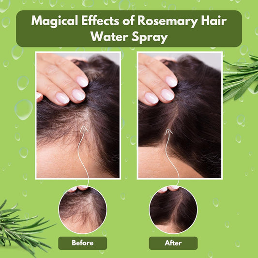 "Edith Naturals Rosemary Revival Spray | Hair Growth & Scalp Nourishment | Nature's Care in a Bottle" Pack of 2